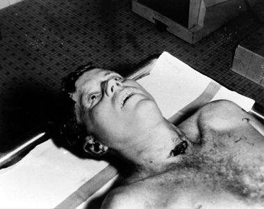 Kennedy's body on autopsy table at Bethesda